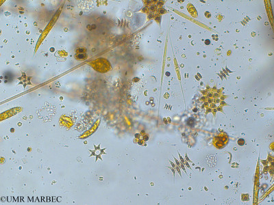 phyto/Pertuis Charentais/Tasdon_st6/PAMPAS 2019-2021/Coelastrum proboscideum (TASDON_St6_230719-046).tif(copy)_thumb.jpg